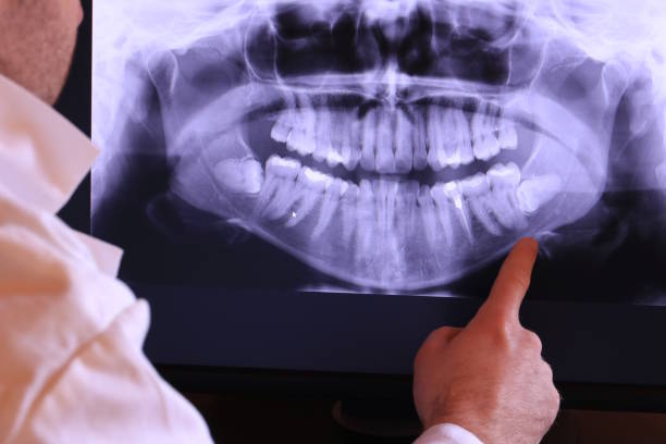 Best Emergency Dentist for Knocked-Out Tooth in Morrow, OH