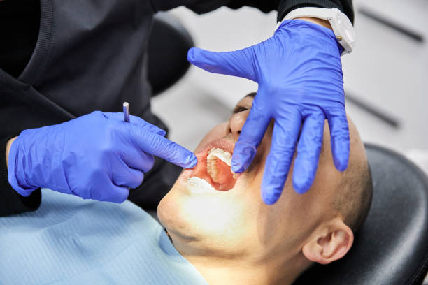 Best Emergency Dental Extractions in Morrow, OH